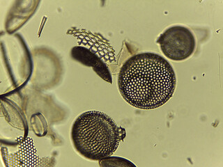 Microscopic Collection of Various Diatom Silica Shells and Biological Specimen Sli © Mohammed