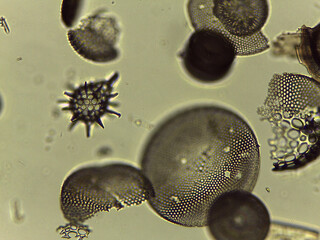 Microscopic Collection of Various Diatom Silica Shells and Biological Specimen Sli © Mohammed