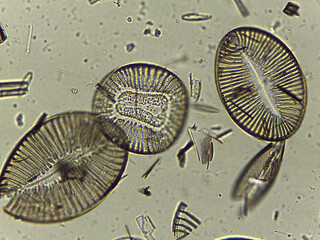High Resolution Microscopic Study of Ornate Diatom Silica Frustules and Aquatic Microorgani © Mohammed