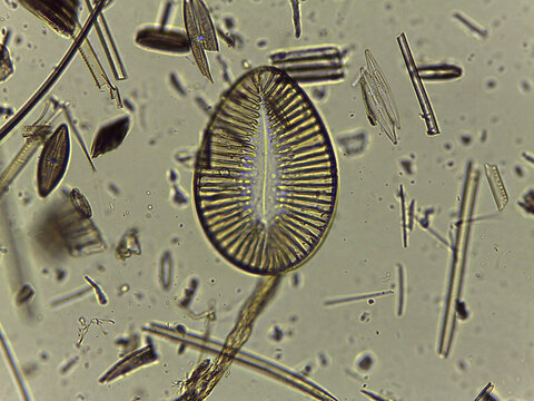 High Resolution Microscopic Study of Ornate Diatom Silica Frustules and Aquatic Microorgani