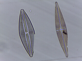 High Resolution Microscopic Study of Ornate Diatom Silica Frustules and Aquatic Microorgani © Mohammed