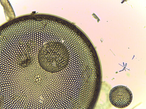 High Resolution Microscopic Study of Ornate Diatom Silica Frustules and Aquatic Microorgani