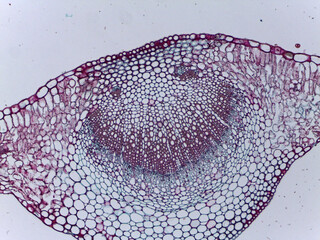 Microscopic Visualization of Microsphaera Asci and Fungal Reproductive Structures An © Mohammed