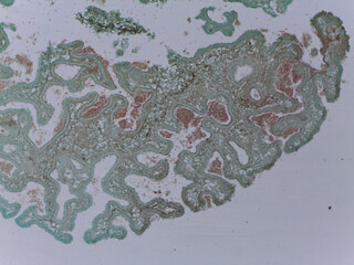 Microscopic Examination of Claviceps Purpurea Conidia and Fungal Reproductive Structu © Mohammed