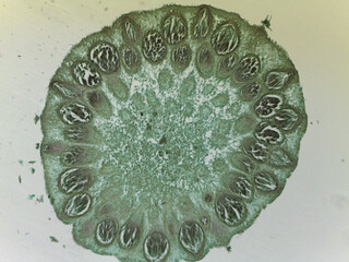 Microscopic Examination of Claviceps Purpurea Conidia and Fungal Reproductive Structu © Mohammed
