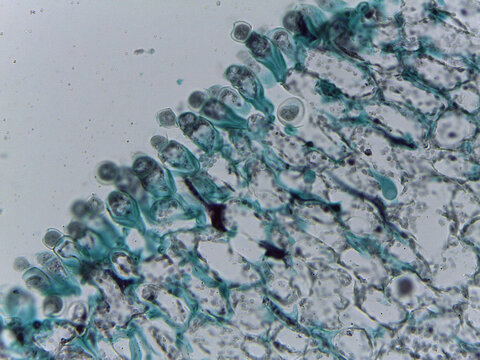 Microscopic Visualization of Cystopus Candidus Albugo White Rust Fungal