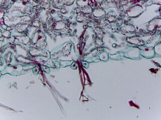 Microscopic Visualization of Peronospora Parasitica and Cystopus Candidus Fungal Infec © Mohammed