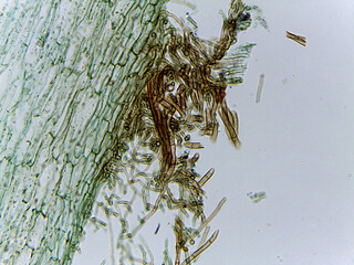 Microscopic Visualization of Sclerotinia Fructicola Apothecium and Fungal Reproductive An © Mohammed