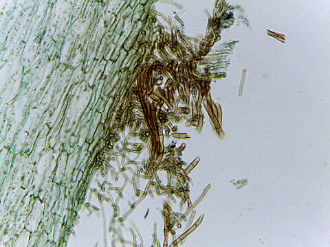 Microscopic Visualization of Sclerotinia Fructicola Apothecium and Fungal Reproductive An