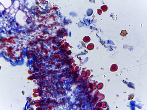 Microscopic Visualization of Puccinia Graminis Wheat Stem Rust Life C