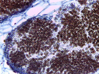 Microscopic Visualization of Ustilago Zeae Corn Smut Teliospores and Fungal Pathogen Ana © Mohammed