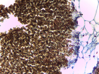 Microscopic Visualization of Ustilago Zeae Corn Smut Teliospores and Fungal Pathogen Ana © Mohammed