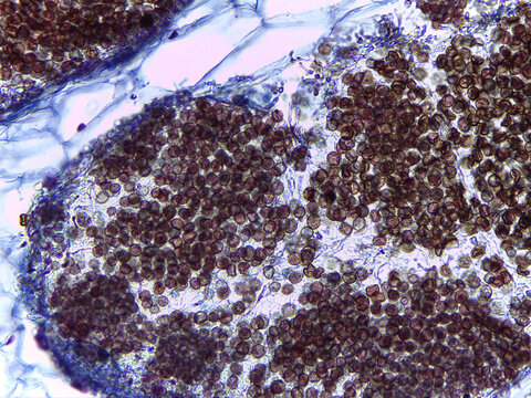 Microscopic Visualization of Ustilago Zeae Corn Smut Teliospores and Fungal Pathogen Ana