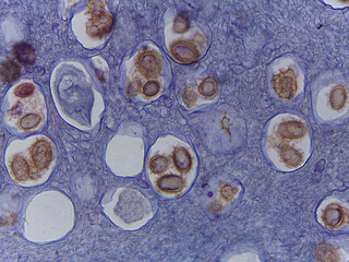 Microscopic Examination of Tuber Rufum Truffle Fruiting Body and Ascospore Morph © Mohammed