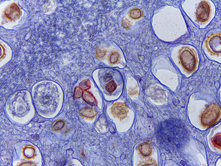 Microscopic Examination of Tuber Rufum Truffle Fruiting Body and Ascospore Morph © Mohammed