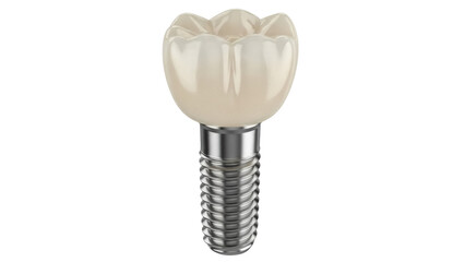 Isolated dental implant with crown for prosthetic tooth restoration procedure, no background