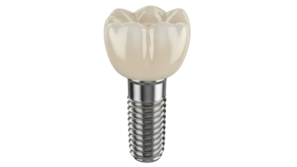 Isolated dental implant with crown for prosthetic tooth restoration procedure, no background