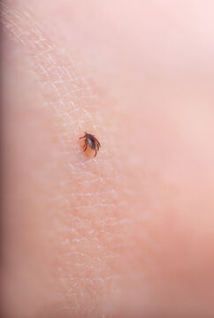 Little tick on human skin. Small Ixodes scapularis suck blood