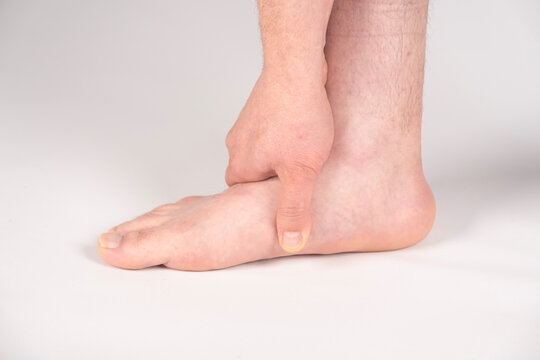 Male foot experiencing discomfort and pain from a flat feet condition or pes planus close-up, illustrating a common podiatry and health problem