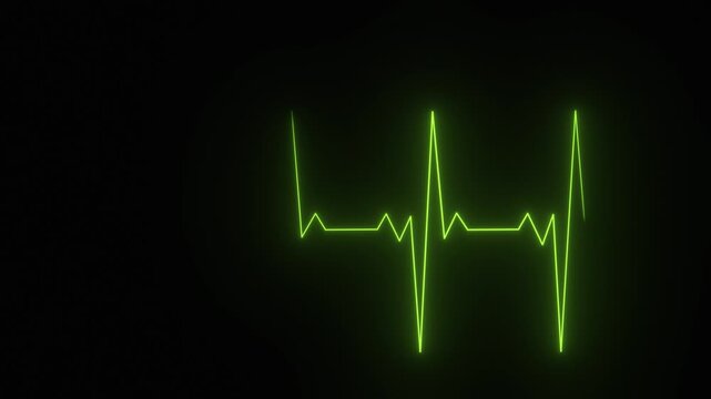 Green heartbeat flatline electrocardiogram medical screen loop on a black chroma key alpha channel background