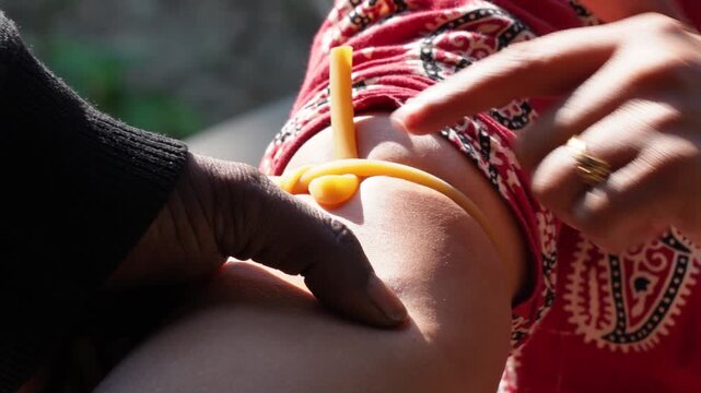 Nurse Locating Vein for Blood Draw​