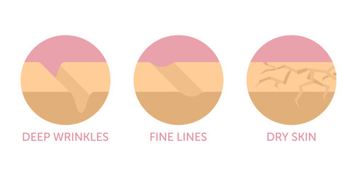 Facial skin problems icons in flat colors, for anti-age products