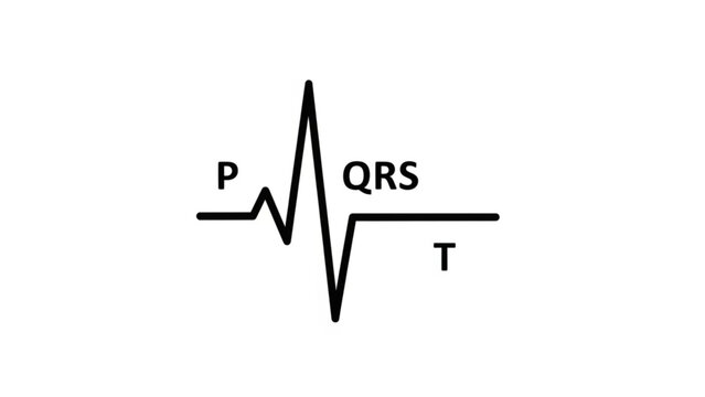 Cardiac Rhythm Diagram: An essential visual representation of a heart's electrical activity, showcasing the distinctive P, QRS, and T waveforms critical to medical understanding. 