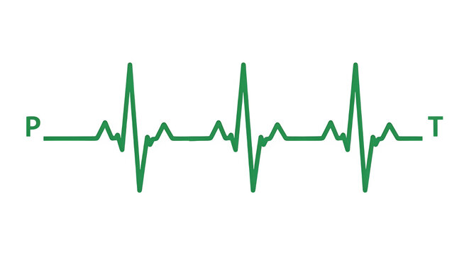 Electrocardiogram ecg heartbeat line graph p qrs t waves medical science concept isolated on transparent background