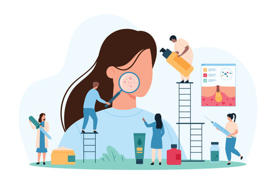 Diagnosis and treatment of teens acne, dermatology and cosmetology. Tiny people study girls face skin through magnifying glass, doctor check pimples and inflammation cartoon vector illustration