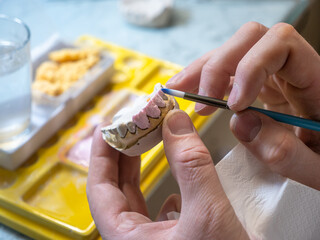 Dental technician painting ceramic tooth crown with pink gum on dental model, handmade prosthetics in professional lab, realistic custom restoration process.