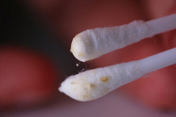 Close up of cerumen. It is a waxy substance secreted in the ear canal of humans and other mammals