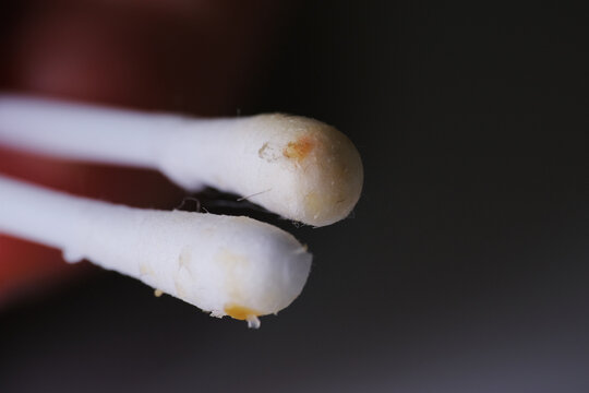 Close up of cerumen. It is a waxy substance secreted in the ear canal of humans and other mammals