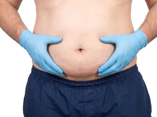 Naklejka premium A medical professional in blue gloves carefully examines the abdominal fat of an overweight man during a health assessment