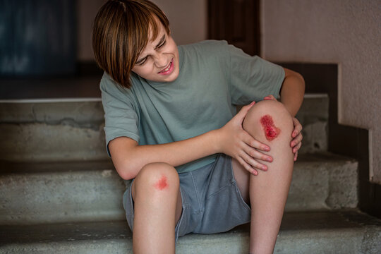 Boy holding his injured knee. Unhappy child boy injured leg pain. Man worried about leg injury in rung. Child injured his knee when he fell on steps. Knee wound on the steps. Blood, scratched skin