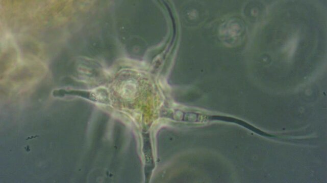 Amoeba with long pseudopodia among organic remains and protozoa in water, enlarged under a microscope.