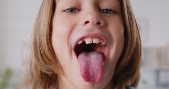 Happy funny kid, little child opening mouth showing tongue, small patient passing health check-up in clinic, medicine care, professional medical aid, otolaryngologist examine, throat pain complaints