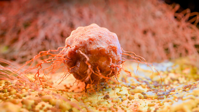 Cancer Cell Growth and Metastasis, Tumor Infection and Invasive Inflammation, Cancerous Cells Spreading Over Tissue, Viral Infection and Lymphocytes in Cancer Immunotherapy, 3D Medical Illustration Re