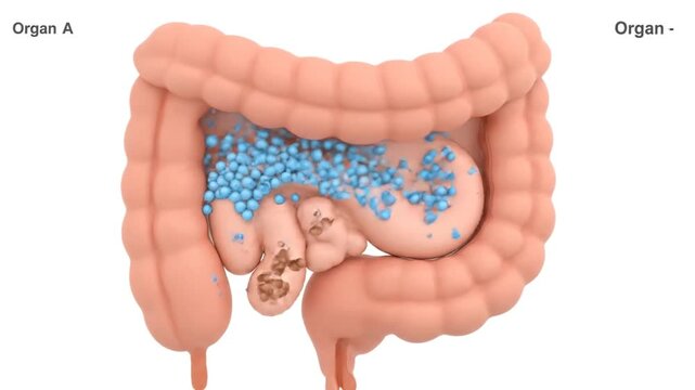Detailed illustration of human intestines with fetus and blue particles inside