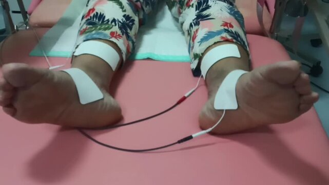 Close up of elderly woman's feet receiving Percutaneous Tibial Nerve Stimulation (PTNS) physiotherapy treatment for overactive bladder and bowel function in the hospital.