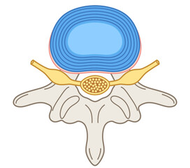 椎間板の構造　腰椎椎間板ヘルニア