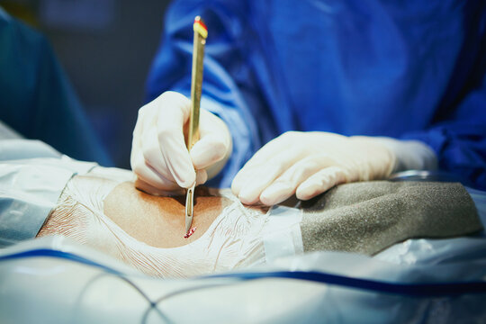 Person, doctor and hands with cut in operating room for surgery operation or procedure. Closeup, medical worker or surgeon with precision tool or surgical gloves for emergency incision in hospital
