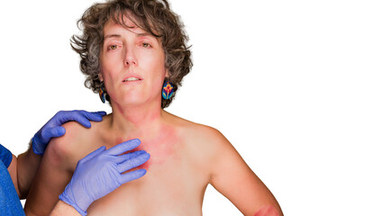 Doctor examining woman with eczema skin problems