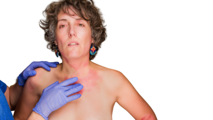 Doctor examining woman with eczema skin problems