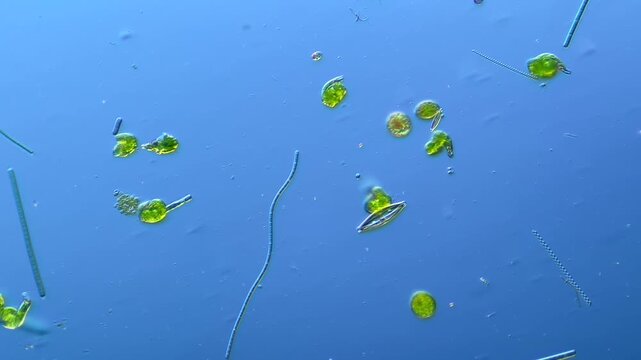 Diatoms and other microorganisms under the microscope at 100x Magnification