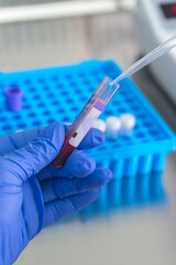 Fototapeta premium Scientist working with blood sample in laboratory.A blood test result for the new rapidly spreading Corona virus pandemic concept.Coronavirus vaccine development