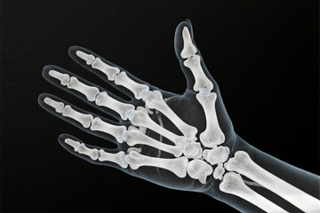 Detailed X-ray Image of Human Hand Bones Showing Skeletal Structure, Ideal for Medical Diagnosis, Orthopedics, and Healthcare Applications