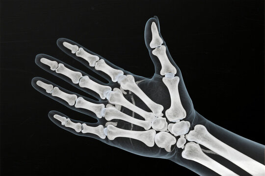 Detailed X-ray Image of Human Hand Bones Showing Skeletal Structure, Ideal for Medical Diagnosis, Orthopedics, and Healthcare Applications