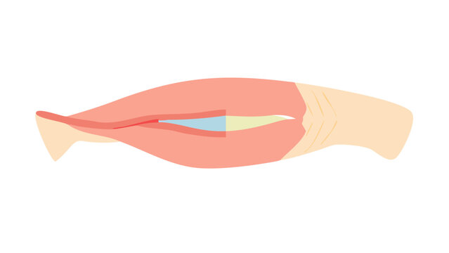 medically accurate muscle illustration of the depressor anguli oris.