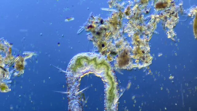 Annelid Aeolosoma under the microscope at 100x Magnification