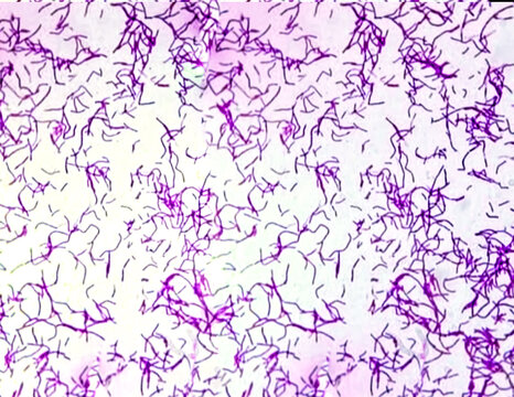 Bacillus anthracis is the etiologic agent of anthrax. A common disease of livestock and occasionally of humans. Micrograph